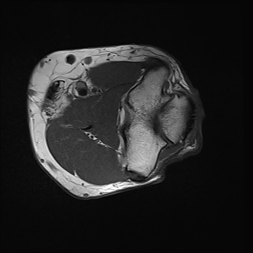 Click on the Serie image to view the images of Wieszt, Gnter